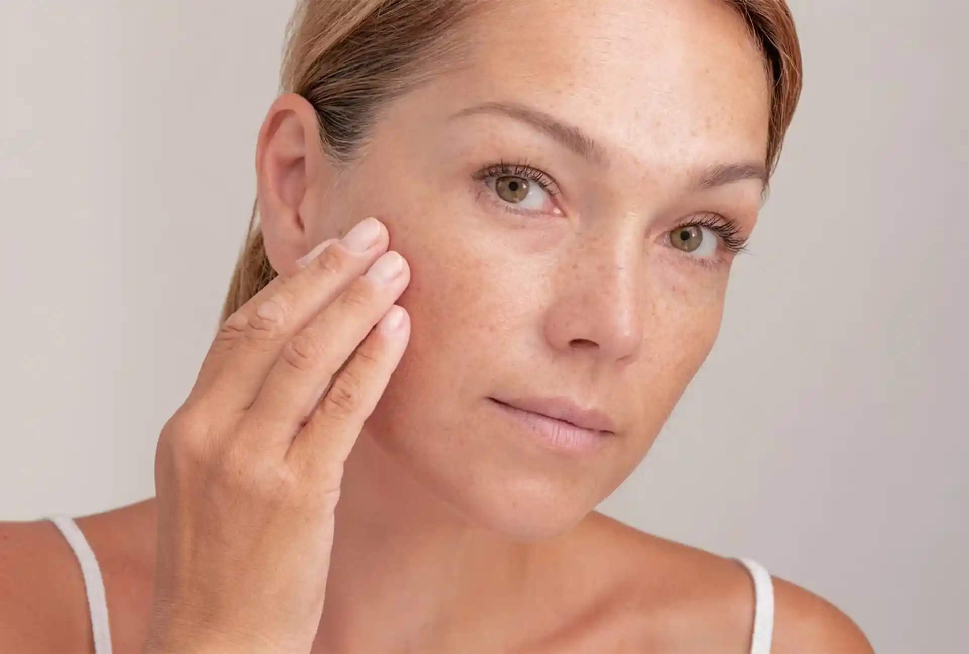 1671490642 actinic keratosis banner