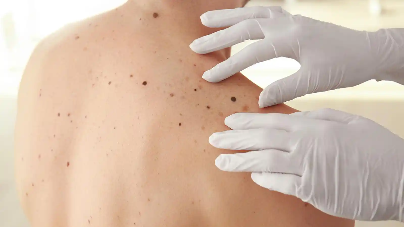 Channel dermatologie shutterstock