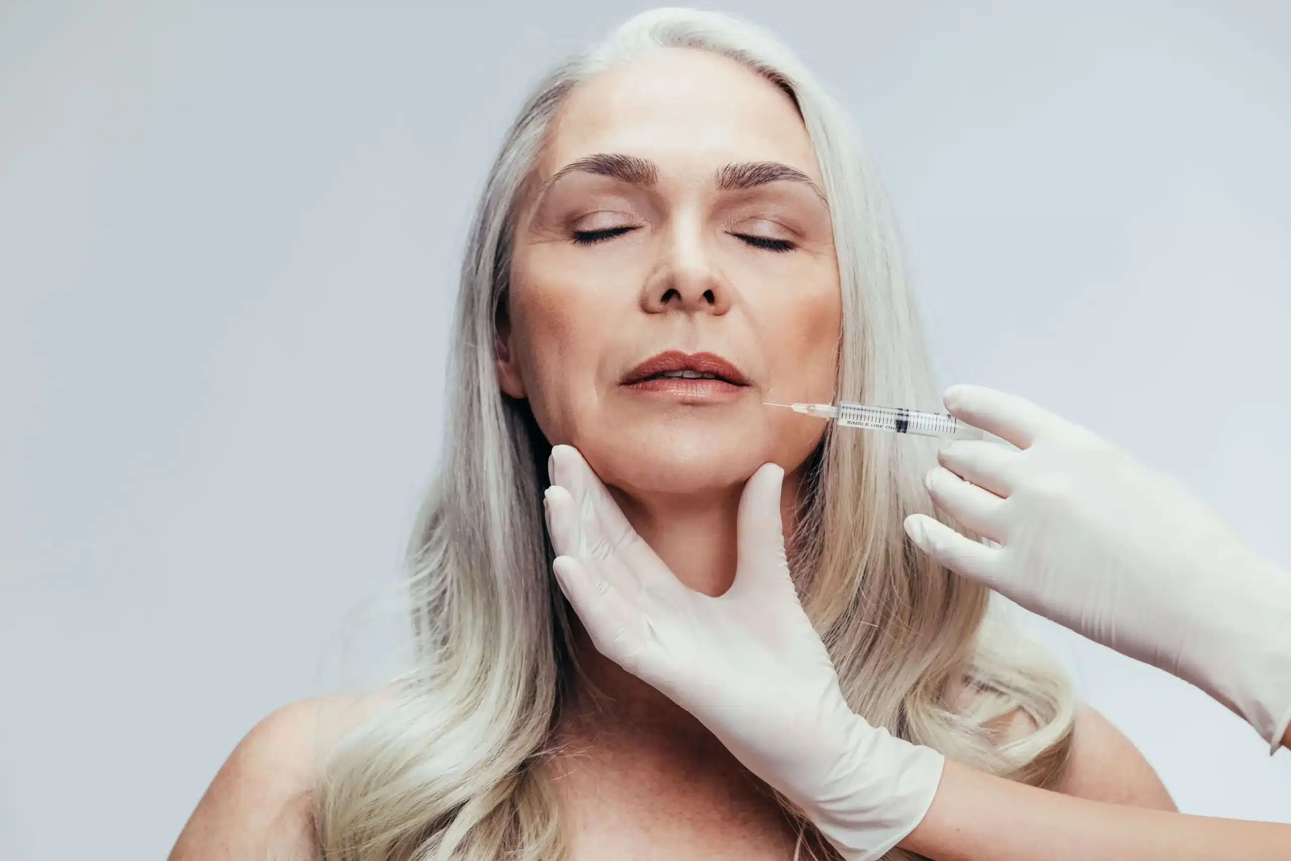 Treatment for Age Spots and Pigment Correction in Ogden UT
