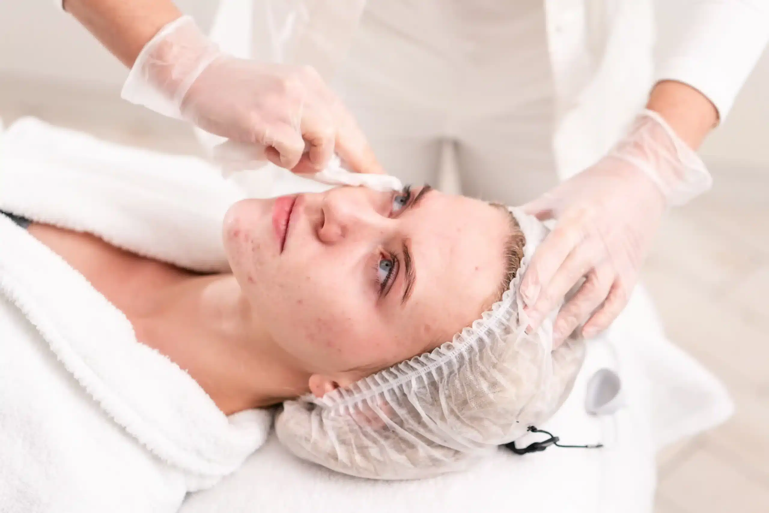 Acne Treatment for Clear Skin in Ogden UT